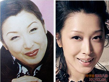娱乐圈女明星大饼脸惊变锥子
