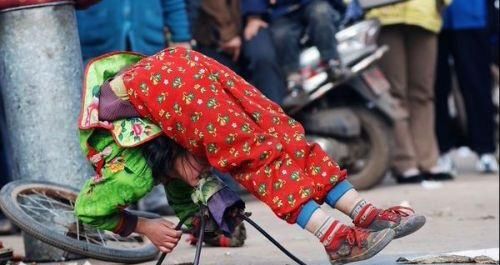 这组图看下去需要勇气 震撼心灵